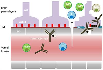 Can Immune Tolerance Be Re-established in Neuromyelitis Optica?